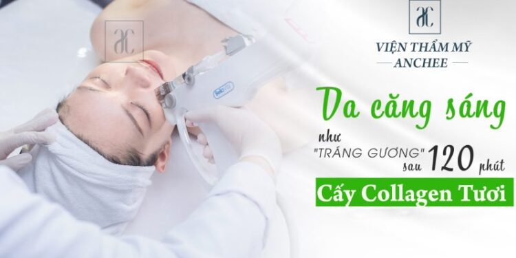 cấy collagen tươi giá bao nhiêu