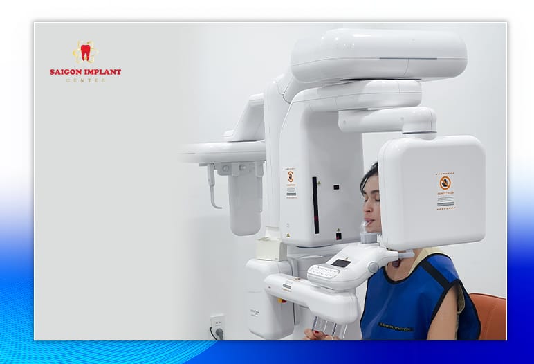 A CBCT 3D scanner used for pre-implant diagnostic imaging at a dental clinic in Vietnam.